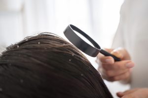 Scalp Health